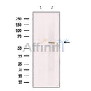 Activin Receptor Type IA Antibody -DF13370