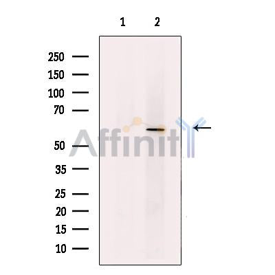 Activin Receptor Type IA Antibody -DF13370