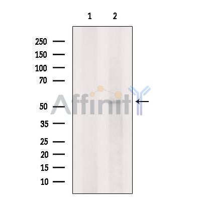 GLRA2 Antibody -DF13373