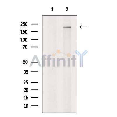 Spt6 Antibody -DF13376