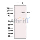 RNF31/HOIP Antibody -DF13379
