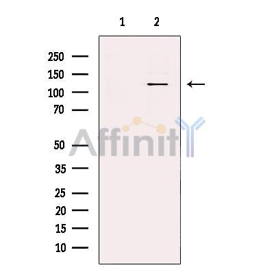RNF31/HOIP Antibody -DF13379