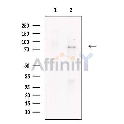 Transferrin Antibody -DF13383