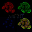 Acid sphingomyelinase Antibody -DF13384