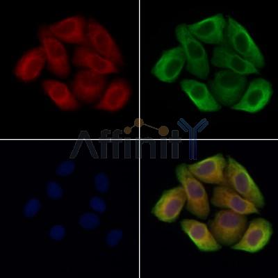 Acid sphingomyelinase Antibody -DF13384