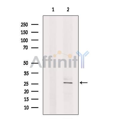 Nociceptin Antibody -DF13385