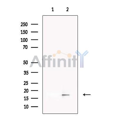 LAMTOR1 Antibody -DF13388