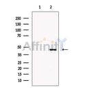 HLA Class I Antibody -DF13389
