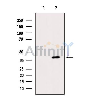 CD1a Antibody -DF13391