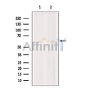 EBF2 Antibody -DF13398