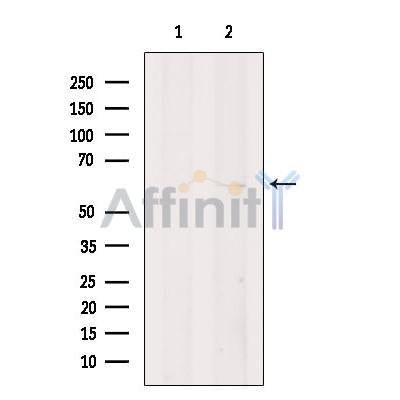EBF2 Antibody -DF13398