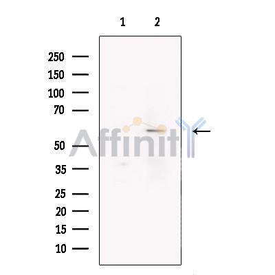 GABA A Receptor beta 3 Antibody -DF13401