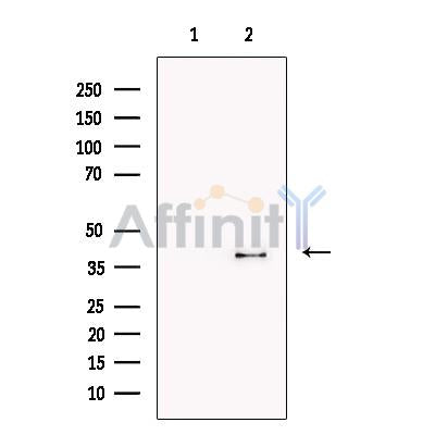 AKR1B10 Antibody -DF13405
