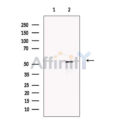 Factor VII Antibody -DF13406