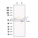 PBX1 Antibody -DF13408
