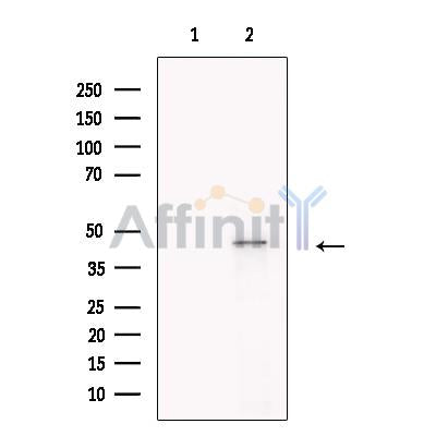 PBX1 Antibody -DF13408