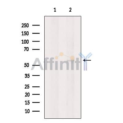 KCNK5 Antibody -DF13412