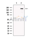 PAPP A2 Antibody -DF13413