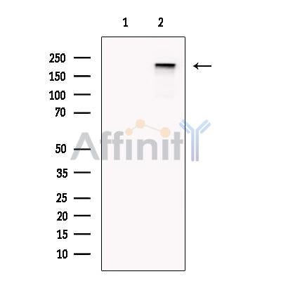 PAPP A2 Antibody -DF13413