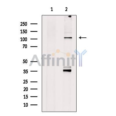 alpha 1 Spectrin Antibody -DF13417