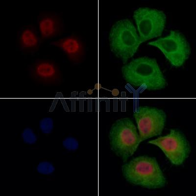 hFANCI Antibody -DF13422