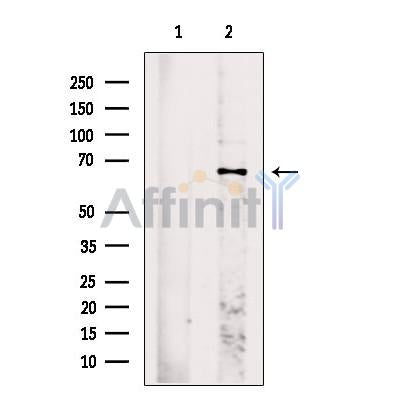 TEM8 Antibody -DF13424
