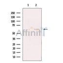 TBLR1 Antibody -DF13426