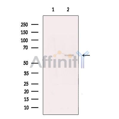 TBLR1 Antibody -DF13426