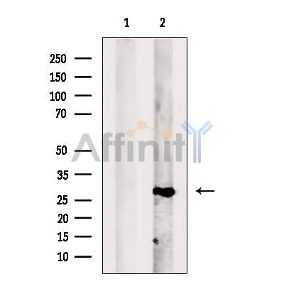 PGAM2 Antibody -DF13447