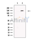 Niemann Pick C1 Antibody -DF13452