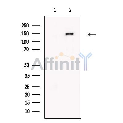 Niemann Pick C1 Antibody -DF13452