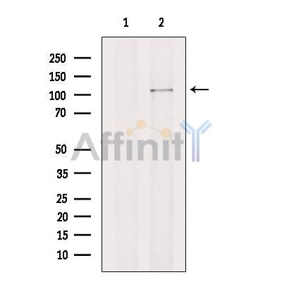 ITIH2 Antibody -DF13454