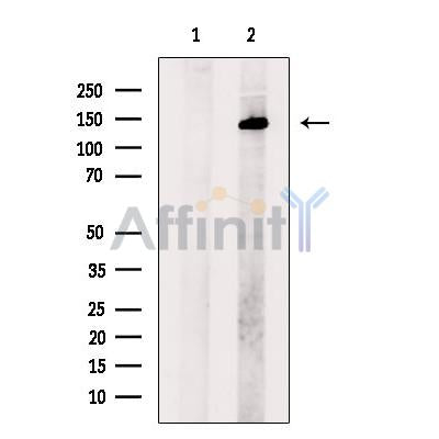SALL1 Antibody -DF13458
