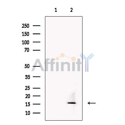 TECK Antibody -DF13462