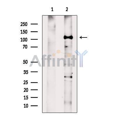HLTF Antibody -DF13471