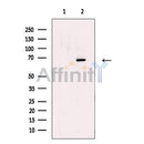 Lysyl tRNA synthetase Antibody -DF13475
