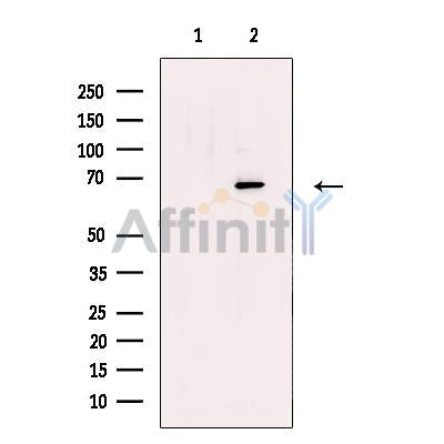 Lysyl tRNA synthetase Antibody -DF13475