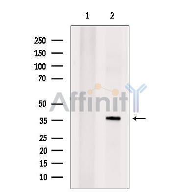 TCF21 Antibody -DF13477