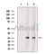 AK2 Antibody -DF13478