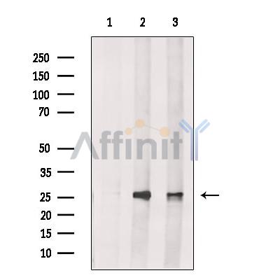 AK2 Antibody -DF13478