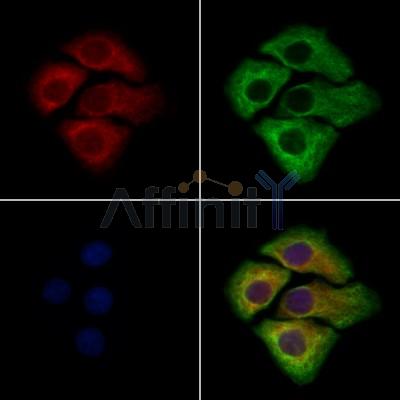 WISP2 Antibody -DF13479
