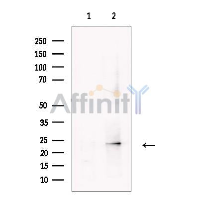 Neurturin Antibody -DF13481
