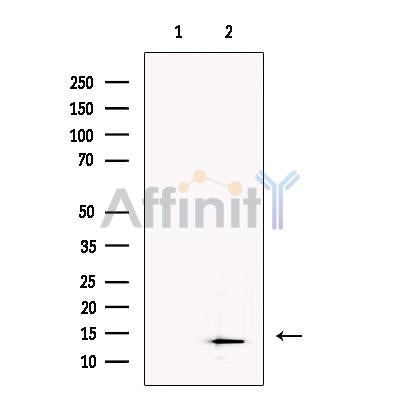 SLIRP Antibody -DF13485