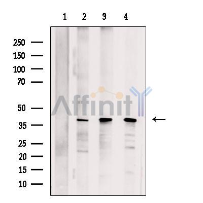 PURA Antibody -DF13493