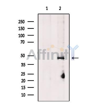 Fumarylacetoacetate hydrolase Antibody -DF13497