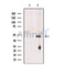 Fumarylacetoacetate hydrolase Antibody -DF13497