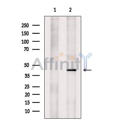 KCNK9 Antibody -DF13498
