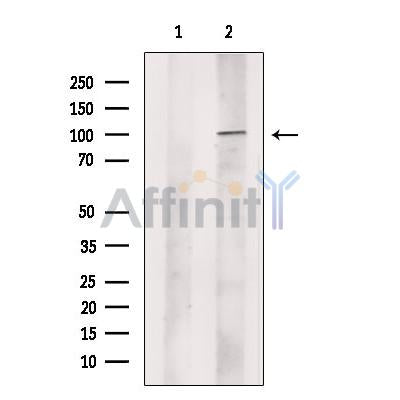 p90 Autoantigen Antibody -DF13505