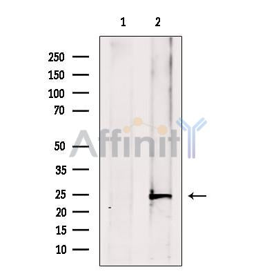 ATP6V1E1 Antibody -DF13510