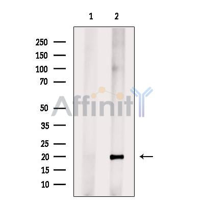 FLJ42280 Antibody -DF13514